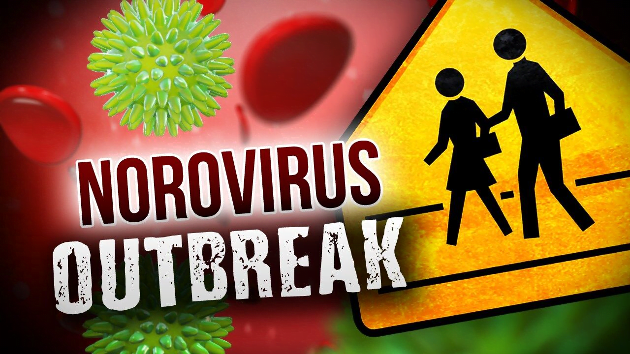 California Restaurant Norovirus Outbreak Nearly 100 Affected By   Image 21 